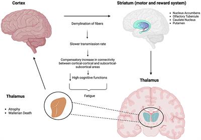 Management of multiple sclerosis fatigue in the digital age: from assessment to treatment